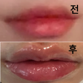 입술필러를 맞고 싶어서 여기저기 찾아보다가 여기가 제일 가격도 착하고 후기도 좋더라구요 ㅎㅎ