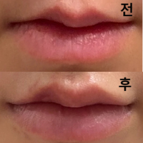 과하지 않고 매우 귀여운 느낌의 입술이 되었습니당!