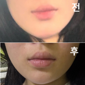 상담언니가 넘 친절하시게 알려주셨어요!