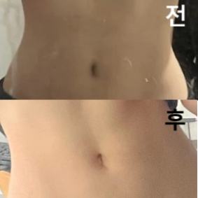 효과가 정말 있어여!!