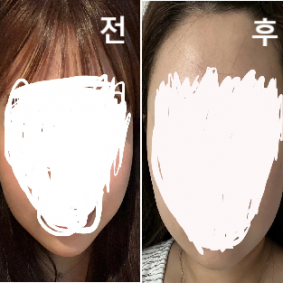 원장님도 친절하시고 궁금한거 여쭤봤는데 친절하게 답변 해 주셨어요!