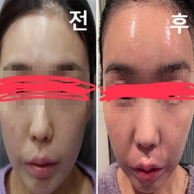 롤리팝 두 번째고 디자인, 효과 모두 만족스러워서 이번에도 들렀습니다! 이번에도 아주 만족스러운 결과랍니다 ♥