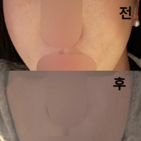 모공에 효과가 너무 좋아요!! 만족합니당~