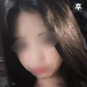 지인추천으로 갔는데 너무 친절하시고 세심하게 챙겨주셔서 좋았고 효과도 좋아서 주변에애서 다 얼굴라인 이뻐졌다고 해줬어요!