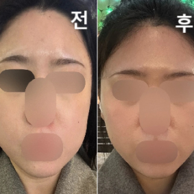 상담 꼼꼼히 잘 해주셨고 고민부위도 딱 찝어서 상담해주셨어요 ㅎㅎ 담에 또 받을 거 같아용!