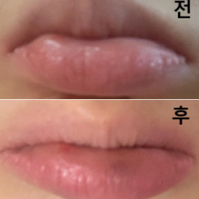 아플 것 같아서 엄청 미루다 맞았는데 참을만했어요!!