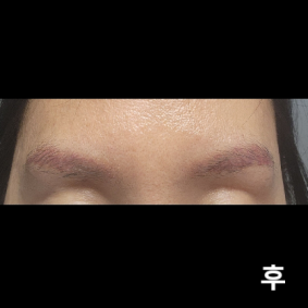 통증 견딜만하고 모두 친절하시네요~ 가성비 좋은듯해요~~