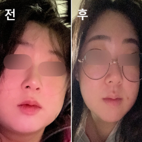 전반적으로 진짜 짱 친절히고 깨끗한 병원, 세심함, 전부 기억하고 챙겨주심! ♥