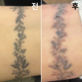 의사선생님 친절하시구 코디분들도 친절하셔서 좋아요!!!