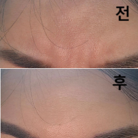 스탭분들 의사쌤 모두 친절하시고 말도 잘 걸어주시고 좋았습니다!