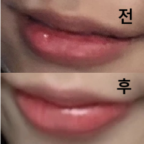 한 번으로 큰 효과도 없겠지만 라인이 조금 정리된게 보였어요~