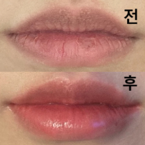 처음 맞아본거라 걱정 많이 했는데 너무 만족해요!!