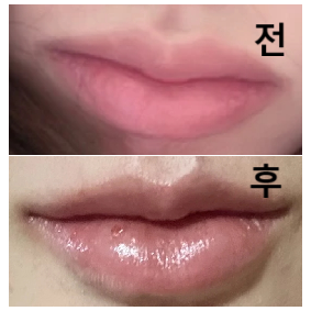실장님, 선생님 모두 엄청 친절하시고 원하는 입술 모양 정확히 알 수 있도록 도와주셨어요!! 결과물 엄청 만족스럽습니다~~