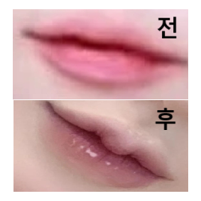 이 병원만 다닙니다... 예약하기도 편하고 의사 선생님도 너무 친절하시고 안 아프게 잘 해주십니다 ㅠㅠ