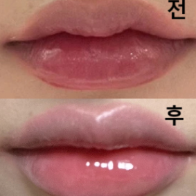 여태 맞아봤던 곳 중 가장 많은 양 넣어주시는 듯..? 만족합니당!