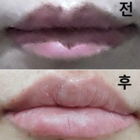 상담부터 일본어 대응이 있어 알기 쉬웠고 입술도 예쁘게 나왔어요~~ 또 올게용~