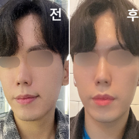 괜찮았습니다! 슈퍼턱이라고 사이즈 업 해서 맞았네여 ㅠㅠ