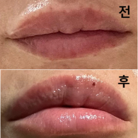 사진 등을 보여주셔서 제대로 상담 받을 수 있었어요!