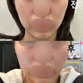 원장님께서 딱 교정할 부분이랑 과하지 않게 넣어주시고 좋은 것 같아요!! 정말 대대대만족입니다..