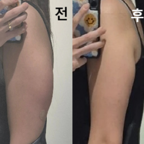 포키주사 패키지로 구매했고 다 끝나서 아쉬워요ㅠ