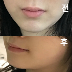 사람은 많았지만 대기는 별로 없고 주사가 정말 안아팠어요!