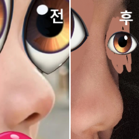 계속 물어보면서 몰딩작업 해주셔서 좋았어요! 그리고 다른 곳보다 안아픈건 확실한 것 같아요! 너무 좋아용!!