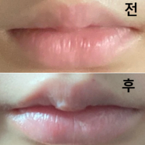 원장님이 엄청 섬세하게 해주시고 정말 친절하세요 담에 리터치 또 받으러 가려구요~!