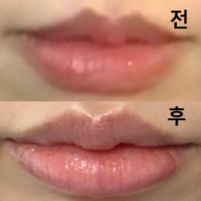 리터치까지 받고 왔는데 진짜 너무너무너무 맘에 들어요!!