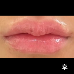 공장형이라 걱정했는데 직원분들 + 원장님들 완전 꼼꼼히 해주셨어요1! 나 여기 단골될지도..??