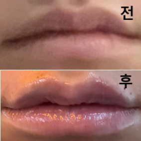 다들 너무 친절하시고 처음이라 질문이 많았는데 하나하나 다 답해주시고 더 필요한 곳 없는지 꼼꼼히 확인해주셨어요!!