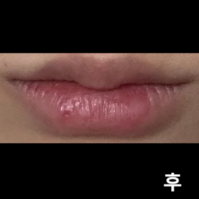 너무 이쁘게 잘 됐어요! 제가 원하는 모양으로 잘 잡아주시고 계속 거울보면서 확인시켜 주시고 만족해용~