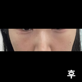 너무 만족해요!! 눈이 차오르는게 실시간으로 보여서 좋아요 :)