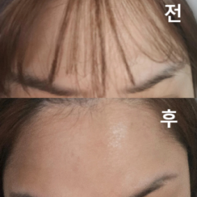 친절하시구 눈을 크게 떠도 주름이 없어요~~