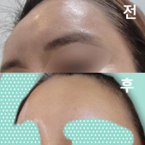 정성스럽게 상담 해 주셔서 만족스러운 마무리였습니다~