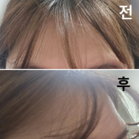 다른 시술 권유도 있었지만 생각만해보라는 정도고 매우 친절하세여!