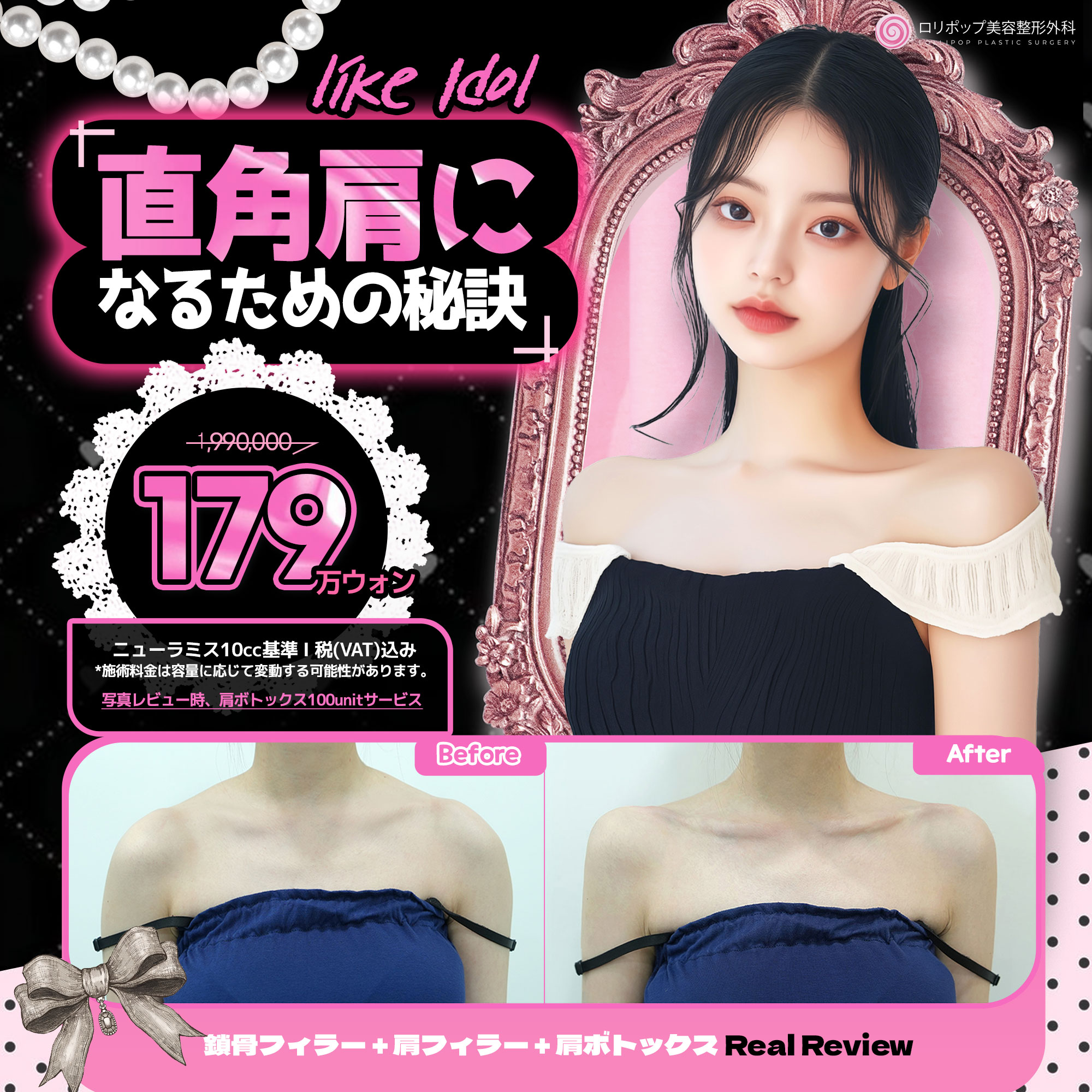 직각어깨 만드는 꿀팁