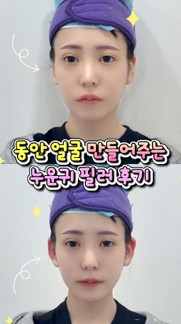 lollipop-plastic-surgery-shorts-thumbnail