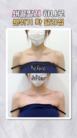 lollipop-plastic-surgery-shorts-thumbnail