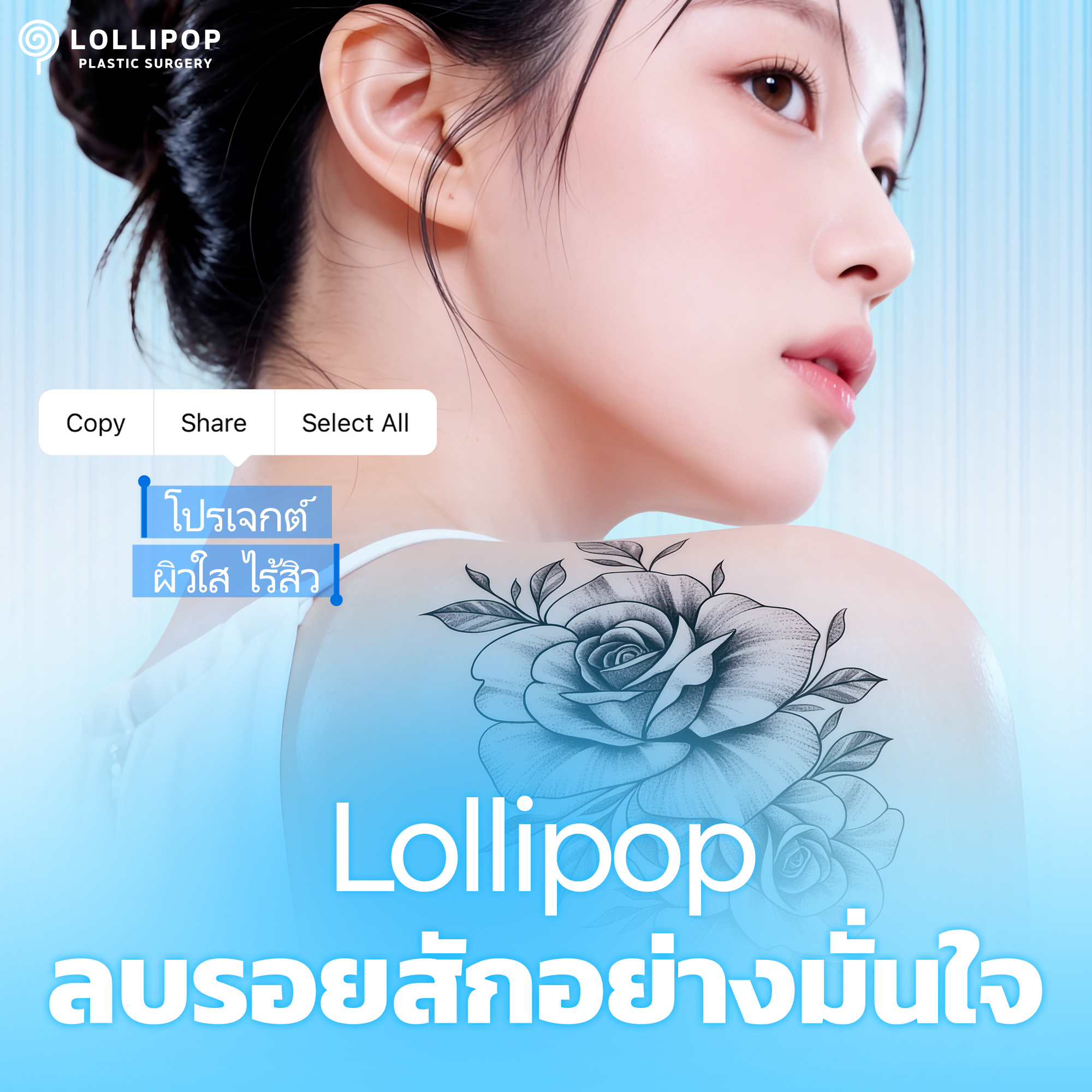 การลบรอยสักรูปอมยิ้ม 5+1