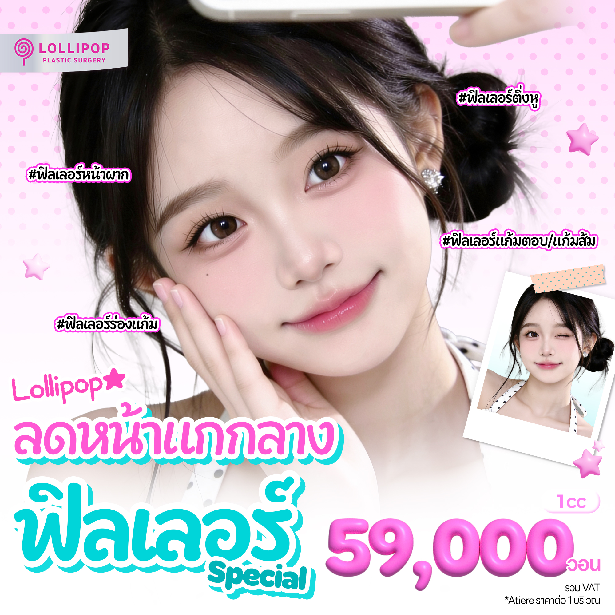 ลดหน้าแกกลาง ฟิลเลอร์