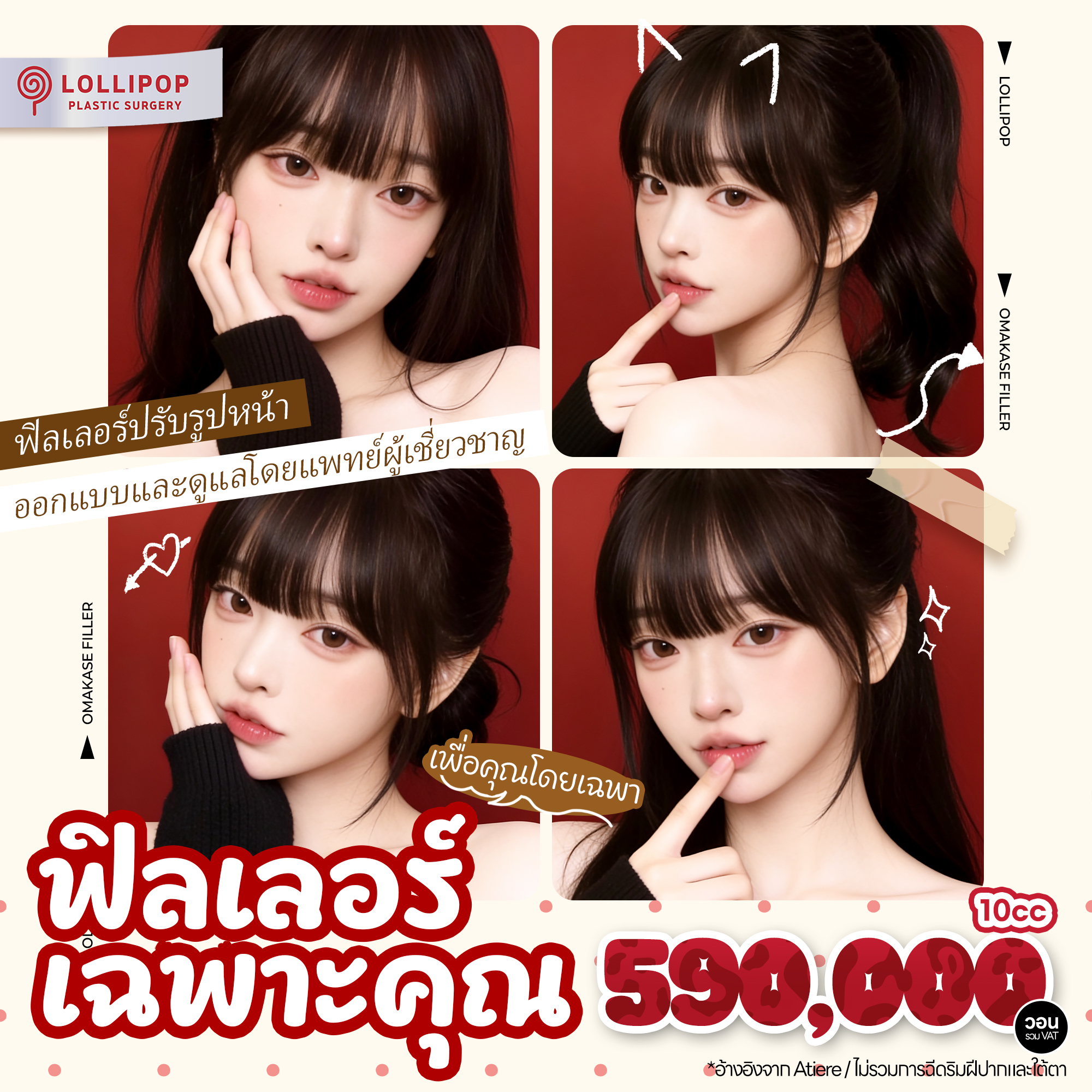 Lollipop ฟิลเลอร์เฉพาะคุณ