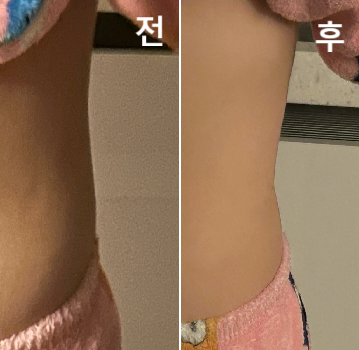 자주 맞는데 효과 좋아요!! 만족하고 있습니당~~