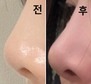 간호사분들이 침착하게 잘 대응해주시고 혼자 쉴 수 있는 휴식공간이 있어 좋았어요~