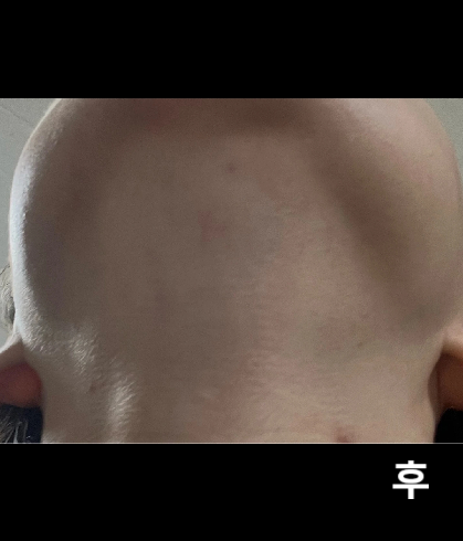 깔끔하게 끝났어요 친절하시구 주의사항 등 잘 알려주셔서 좋았습니다~ 추천해여~