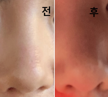 가격도 저렴하고 후기도 좋아서 맞게 되었어요~