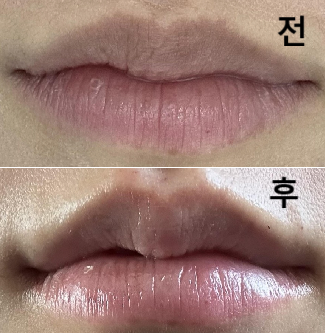 원장님 친절하시고 간호사쌤듀 좋아용~