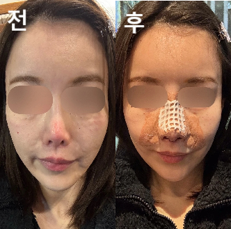 대기시간도 고려해서 예약을 잡아주시고 가격도 저렴해서 추천드립니다!
