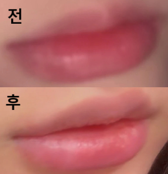원하는 입술이 뭔지 잘 상담해주셔서 너무 예쁘게 잘 된 거 같아요~ 예쁜 입술 만들어주셔서 감사해요 :)