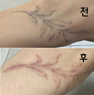 제일 비용이 저렴하고 간호사,스탭, 의사쌤도 친절하셨어요~