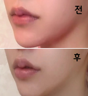 저렴한 가격에 훌륭한 기술의 클리닉 !!
